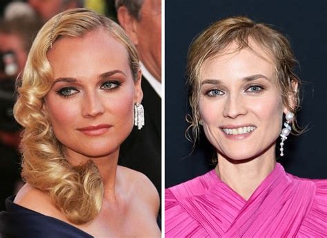 diane kruger breast implants|Successful Plastic Surgery and Celebrities